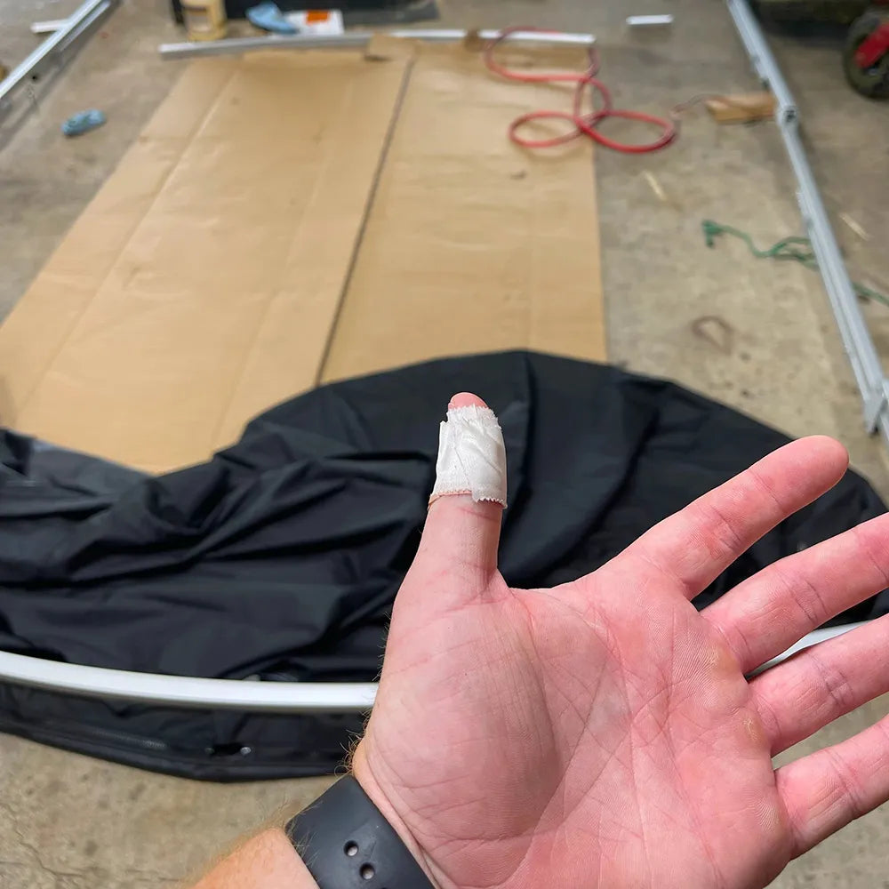 Hand with bandaged thumb